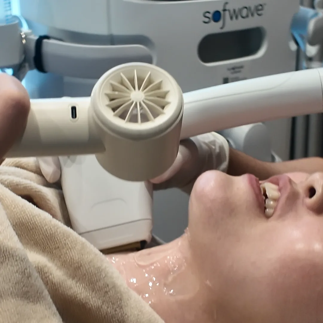 A round-headed handheld applicator near a person’s jaw, with gel on the neck and a Sofwave console behind