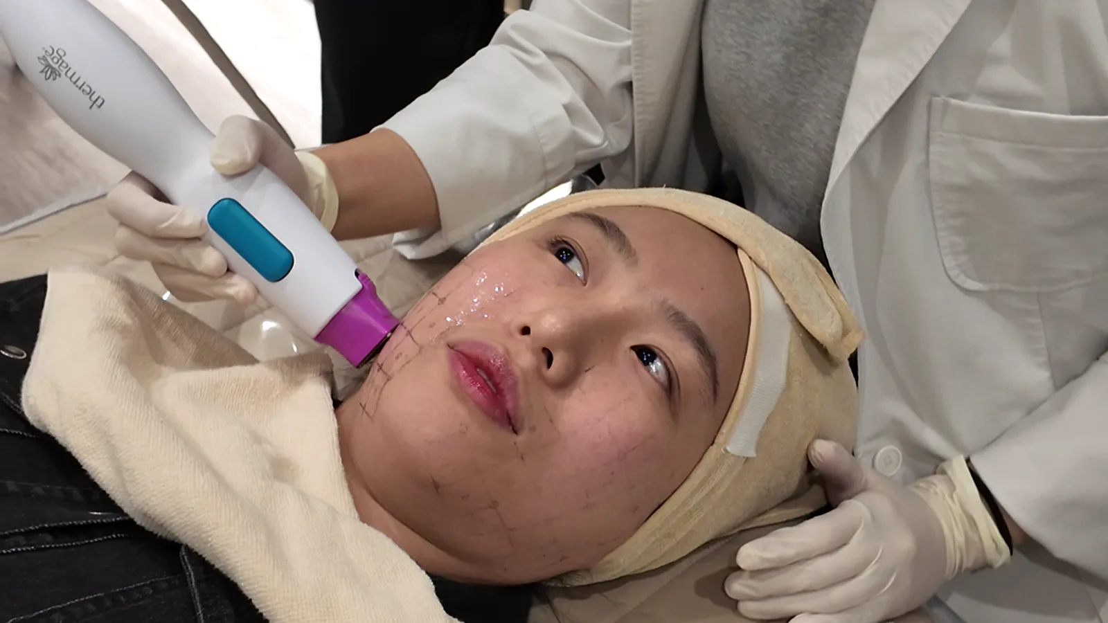 thermage 로고가 보이는 핸드피스가 격자가 그려지고 젤이 발린 볼에 닿고 사람이 위를 올려다보는 모습