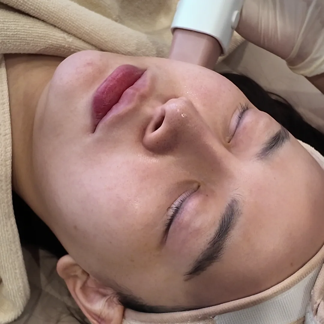 눈을 감고 수건 헤어밴드를 한 누운 얼굴을 가까이 본 모습과 관자놀이에 핸드피스를 든 장갑 낀 손