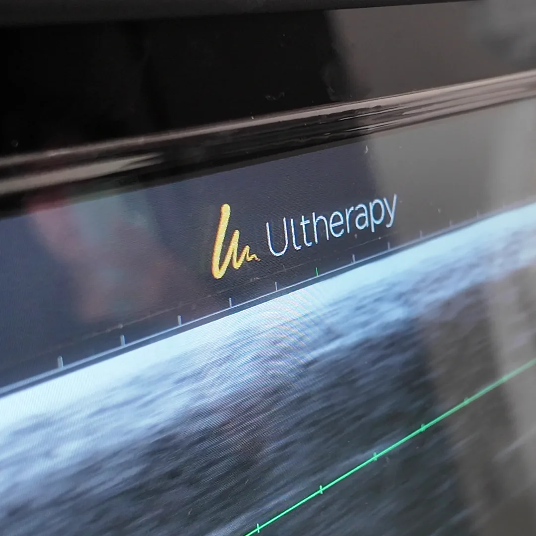 จอมอนิเตอร์ที่แสดงโลโก้ Ultherapy เหนือภาพอัลตราซาวด์สีเทา