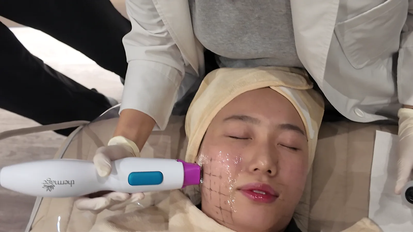A white Thermage handpiece with a purple tip touching a gel-covered cheek marked with a drawn grid, held by a gloved hand, with the person lying down in a towel headband
