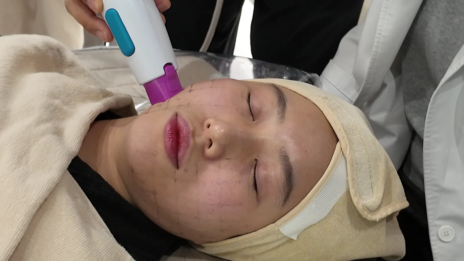 눈을 감고 수건 헤어밴드를 한 사람의 볼 위에 보라색 팁 핸드피스가 놓여 있는 모습