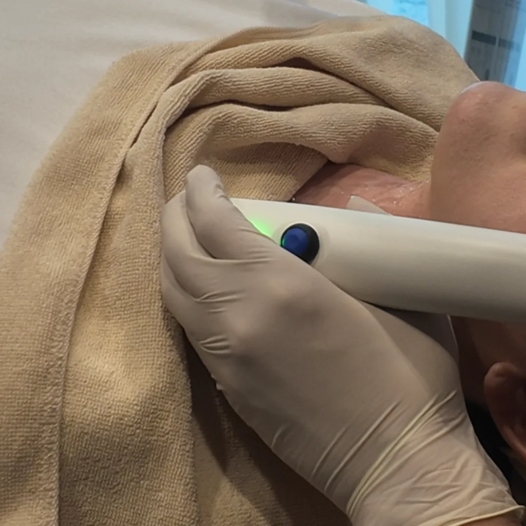 A gloved hand holding a slim handheld applicator with a green light against the skin beside a rolled towel